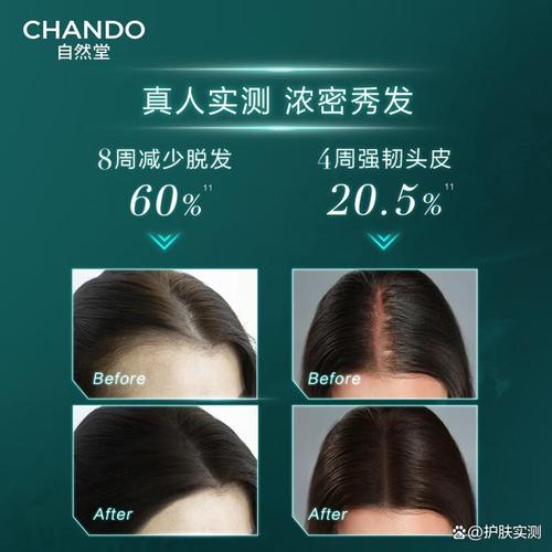 頭皮精華哪個牌子效果比較好,選擇適合你的護理方案